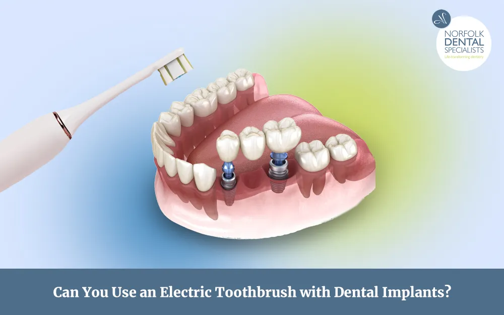 Electric toothbrush over dental implants