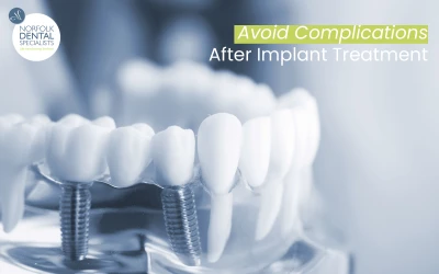 image of dental implants with overlaid text reading 'Avoid Complications After Implant Treatment'