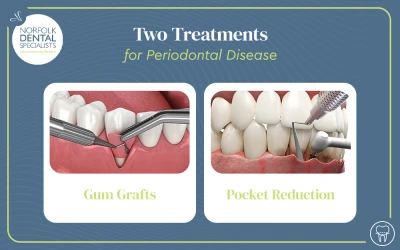 Two Treatments for Periodontal Disease that Have Aesthetic Benefits